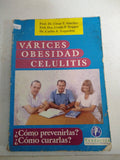 Varices obesidad celulitis