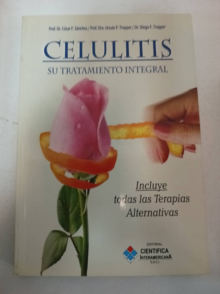 Celulitis, su tratamiento integral