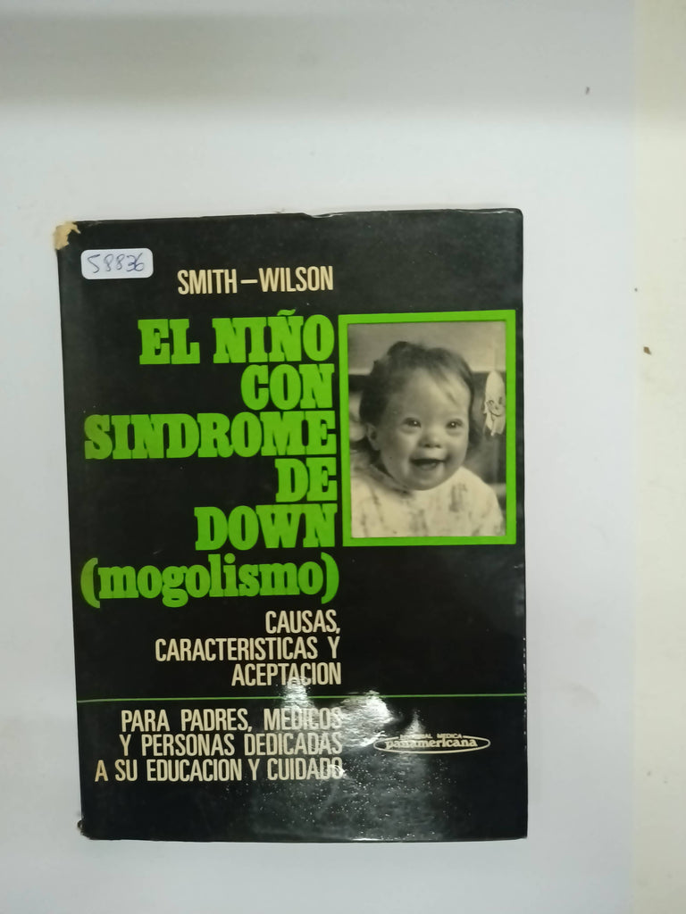 El Niño Con Sindrome De Down Mogolismo