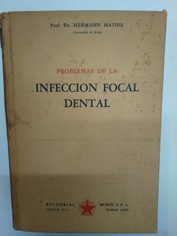 Problemas de la infección focal dental