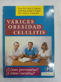 Varices obesidad celulitis