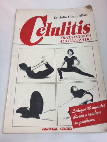 Celulitis