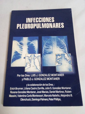 Infecciones pulmonares